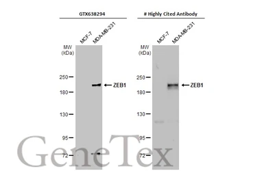 Anti-ZEB1 antibody [HL2245] used in Western Blot (WB). GTX638294