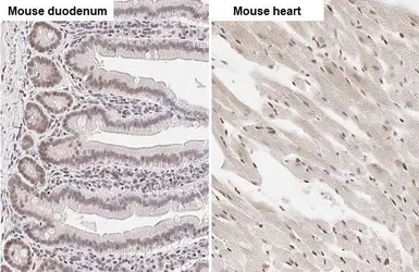 Anti-ZEB1 antibody [HL2245] used in IHC (Paraffin sections) (IHC-P). GTX638294