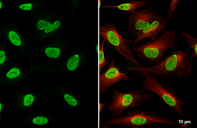 Anti-ZEB1 antibody [HL2245] used in Immunocytochemistry/ Immunofluorescence (ICC/IF). GTX638294