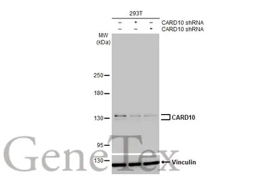 Anti-CARD10 antibody [HL2261] used in Western Blot (WB). GTX638313