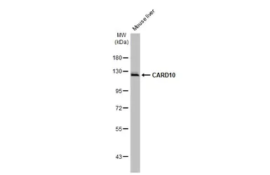 Anti-CARD10 antibody [HL2261] used in Western Blot (WB). GTX638313