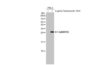 Anti-GADD153 antibody [HL2262] used in Western Blot (WB). GTX638314
