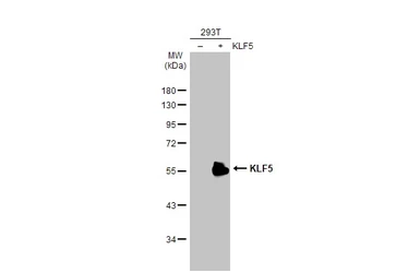 Anti-KLF5 antibody [HL2269] used in Western Blot (WB). GTX638321