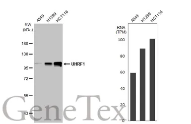 Anti-UHRF1 antibody [HL2287] used in Western Blot (WB). GTX638342