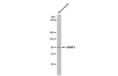 Anti-UHRF1 antibody [HL2287] used in Western Blot (WB). GTX638342