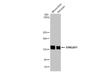 Anti-SYNGAP1 antibody [HL2292] used in Western Blot (WB). GTX638347