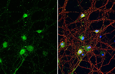 Anti-SYNGAP1 antibody [HL2292] used in Immunocytochemistry/ Immunofluorescence (ICC/IF). GTX638347