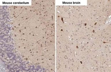 Anti-RNF31 antibody [HL2295] used in IHC (Paraffin sections) (IHC-P). GTX638350