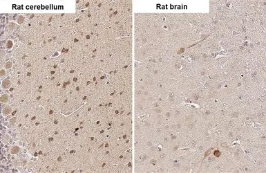 Anti-RNF31 antibody [HL2295] used in IHC (Paraffin sections) (IHC-P). GTX638350
