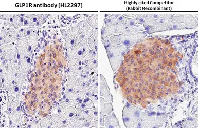 Anti-GLP1R antibody [HL2297] used in IHC (Paraffin sections) (IHC-P). GTX638352