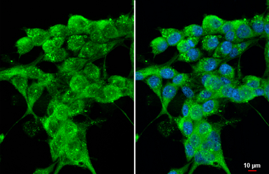 Anti-Cathepsin S antibody [HL2302] used in Immunocytochemistry/ Immunofluorescence (ICC/IF). GTX638369
