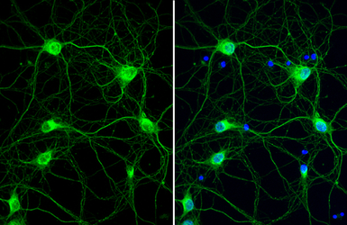 Anti-Cathepsin S antibody [HL2302] used in Immunocytochemistry/ Immunofluorescence (ICC/IF). GTX638369
