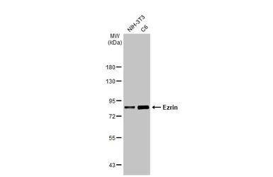 Anti-Ezrin antibody [HL2327] used in Western Blot (WB). GTX638490