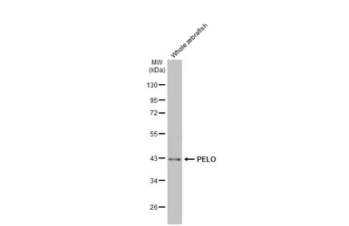 Anti-PELO antibody [HL2345] used in Western Blot (WB). GTX638548