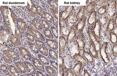Anti-PELO antibody [HL2345] used in IHC (Paraffin sections) (IHC-P). GTX638548