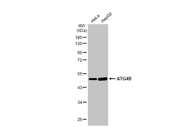 Anti-ATG4B antibody [HL2348] used in Western Blot (WB). GTX638551