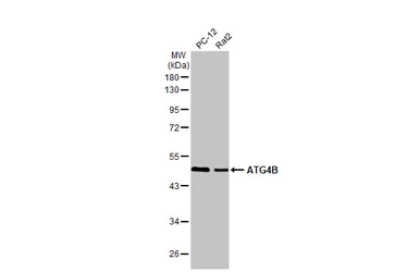 Anti-ATG4B antibody [HL2348] used in Western Blot (WB). GTX638551
