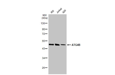 Anti-ATG4B antibody [HL2348] used in Western Blot (WB). GTX638551