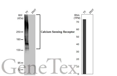Anti-Calcium Sensing Receptor antibody [HL2357] used in Western Blot (WB). GTX638563