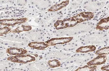 Anti-Calcium Sensing Receptor antibody [HL2357] used in IHC (Paraffin sections) (IHC-P). GTX638563