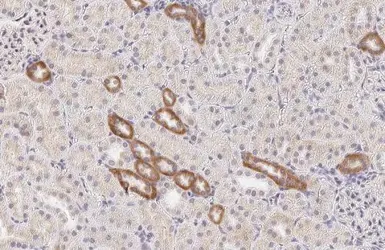 Anti-Calcium Sensing Receptor antibody [HL2357] used in IHC (Paraffin sections) (IHC-P). GTX638563