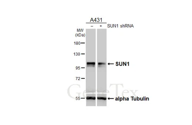Anti-SUN1 antibody [HL2366] used in Western Blot (WB). GTX638572