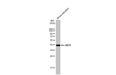 Anti-HEY1 antibody [HL2367] used in Western Blot (WB). GTX638573