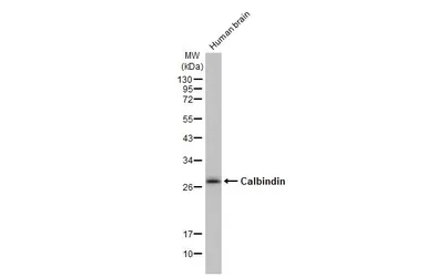 Anti-Calbindin antibody [HL2378] used in Western Blot (WB). GTX638586
