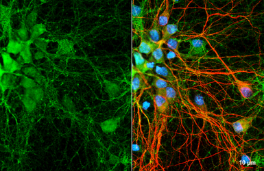 Anti-Calbindin antibody [HL2379] used in Immunocytochemistry/ Immunofluorescence (ICC/IF). GTX638587