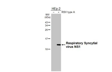 Anti-Respiratory Syncytial virus NS1 antibody [HL2383] used in Western Blot (WB). GTX638591