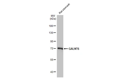 Anti-GALNT6 antibody [HL2392] used in Western Blot (WB). GTX638601
