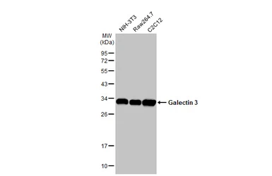 Anti-Galectin 3 antibody [HL2396] used in Western Blot (WB). GTX638613