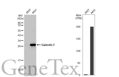 Anti-Galectin 3 antibody [HL2397] used in Western Blot (WB). GTX638614