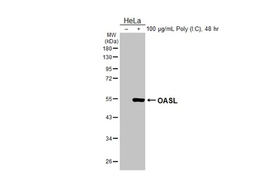 Anti-OASL antibody [HL2399] used in Western Blot (WB). GTX638616