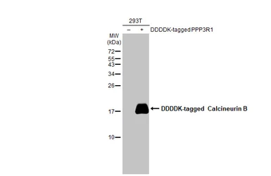 Anti-Calcineurin B antibody [HL2419] used in Western Blot (WB). GTX638641