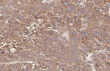 Anti-Transferrin antibody [HL2429] used in IHC (Paraffin sections) (IHC-P). GTX638745