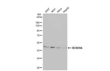 Anti-BCKDHA antibody [HL2434] used in Western Blot (WB). GTX638750