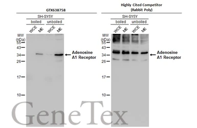 Anti-Adenosine A1 Receptor antibody [HL2442] used in Western Blot (WB). GTX638758