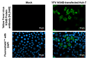 Anti-Yellow Fever virus NS4B Protein antibody [HL2449] used in Immunocytochemistry/ Immunofluorescence (ICC/IF). GTX638767