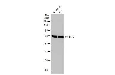 Anti-FUS antibody [HL2454] used in Western Blot (WB). GTX638772