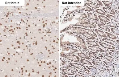 Anti-FUS antibody [HL2454] used in IHC (Paraffin sections) (IHC-P). GTX638772