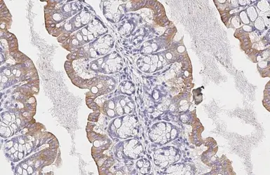 Anti-SMYD3 antibody [HL2464] used in IHC (Paraffin sections) (IHC-P). GTX638782