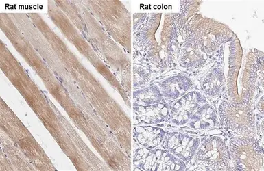 Anti-SMYD3 antibody [HL2464] used in IHC (Paraffin sections) (IHC-P). GTX638782