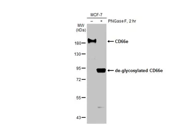 Anti-CD66e antibody [HL2467] used in Western Blot (WB). GTX638816