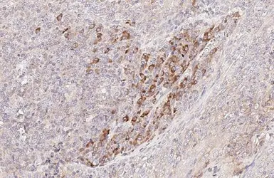 Anti-CCR4 antibody [HL2481] used in IHC (Paraffin sections) (IHC-P). GTX638830