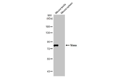 Anti-Vasa antibody [HL2485] used in Western Blot (WB). GTX638835