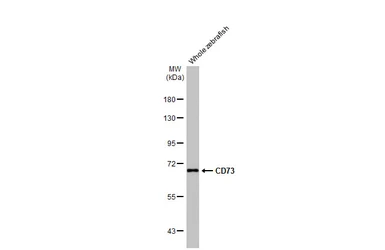Anti-CD73 antibody [HL2493] used in Western Blot (WB). GTX638851