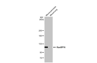 Anti-RanBP16 antibody [HL2510] used in Western Blot (WB). GTX638871
