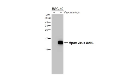 Anti-Mpox virus A29L antibody [HL2527] used in Western Blot (WB). GTX638888