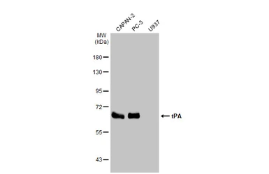 Anti-tPA antibody [HL2585] used in Western Blot (WB). GTX639036